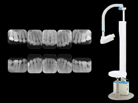 デジタルレントゲン装置