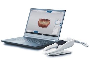 高性能口腔内スキャナー